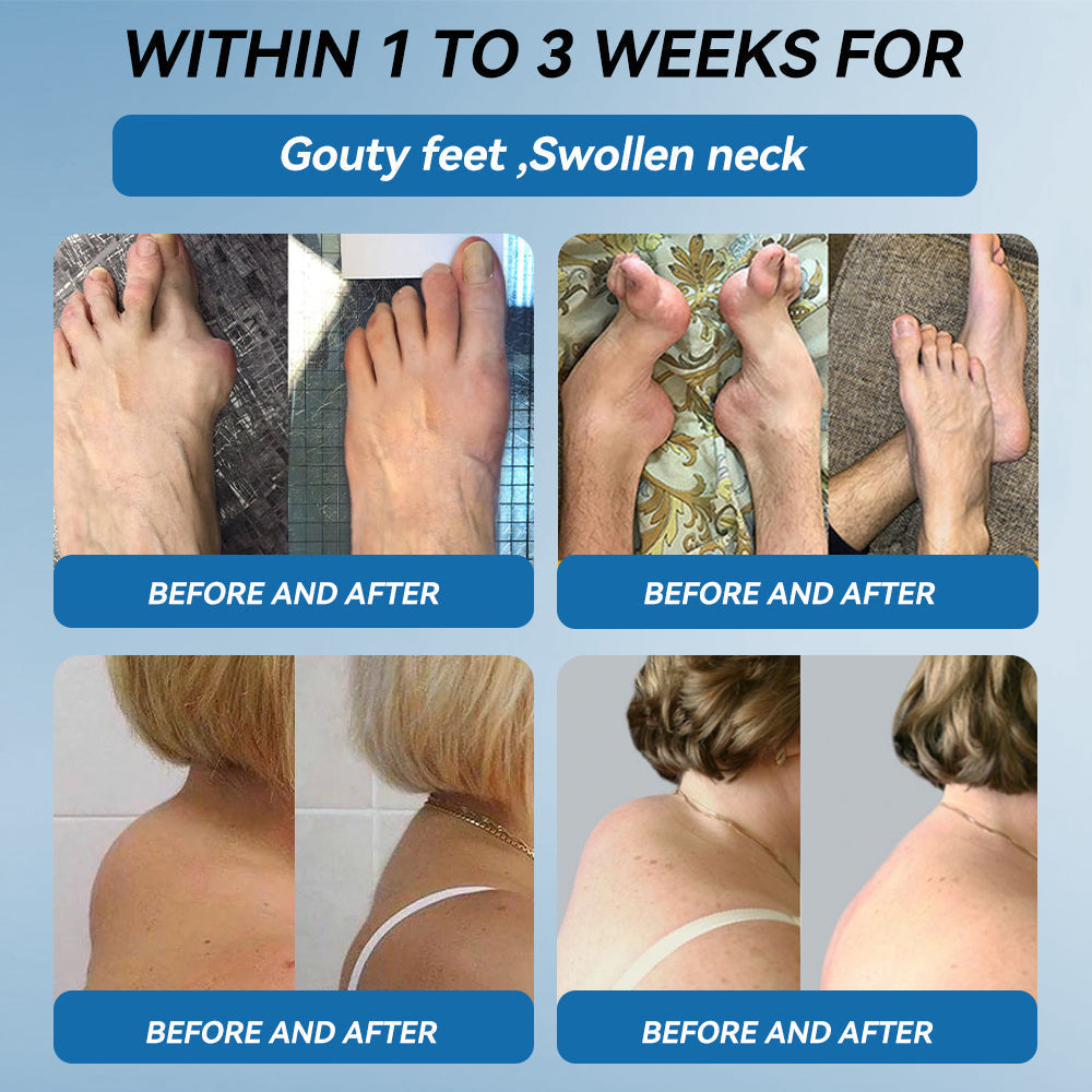 ๐ฆ๐บ๐๐ฅ๐ฒ๐ฌ๐ฆ๐ฎ๐ฌยฎ ๐๐๐-๐๐๐ ๐๐จ๐ข๐ง๐ญ ๐๐๐๐ฅ๐ข๐ง๐  ๐๐ซ๐๐๐ฆ๐ฆ๐บ