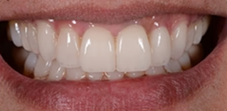 Ourlyard® Tooth Health Mineral Powder 25 Ourlyard® Tooth Health Mineral Powder