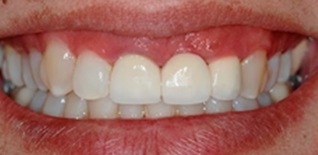 Ourlyard® Tooth Health Mineral Powder 21 Ourlyard® Tooth Health Mineral Powder