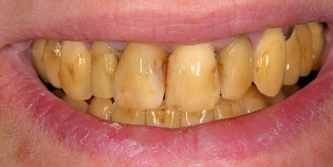 Ourlyard® Tooth Health Mineral Powder 37 Ourlyard® Tooth Health Mineral Powder