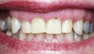 Ourlyard® Tooth Health Mineral Powder 29 Ourlyard® Tooth Health Mineral Powder