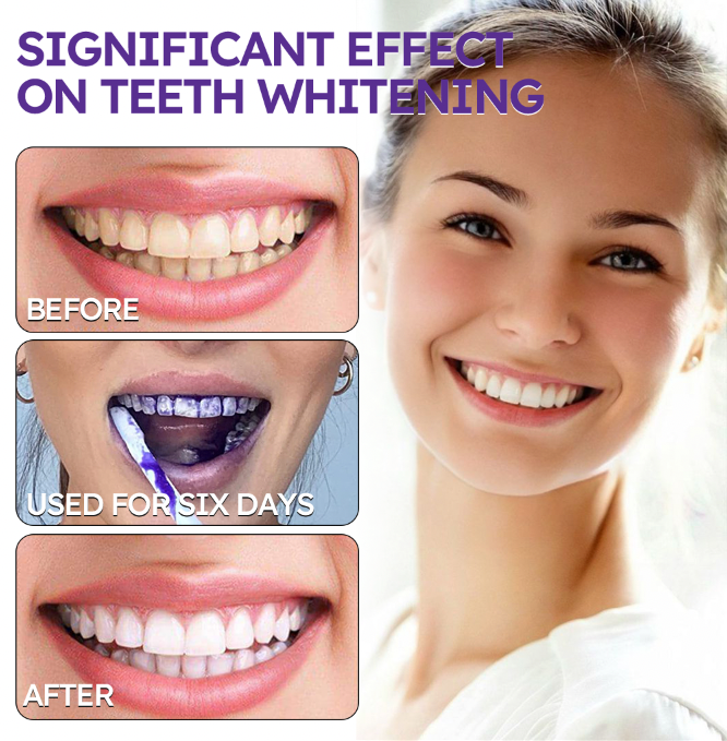 Ourlyard® Tooth Health Mineral Powder 30 Ourlyard® Tooth Health Mineral Powder