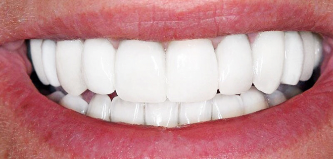 Ourlyard® Tooth Health Mineral Powder 41 Ourlyard® Tooth Health Mineral Powder