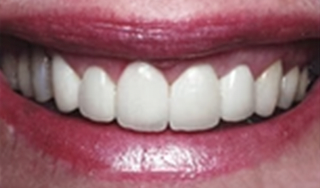 Ourlyard® Tooth Health Mineral Powder 33 Ourlyard® Tooth Health Mineral Powder