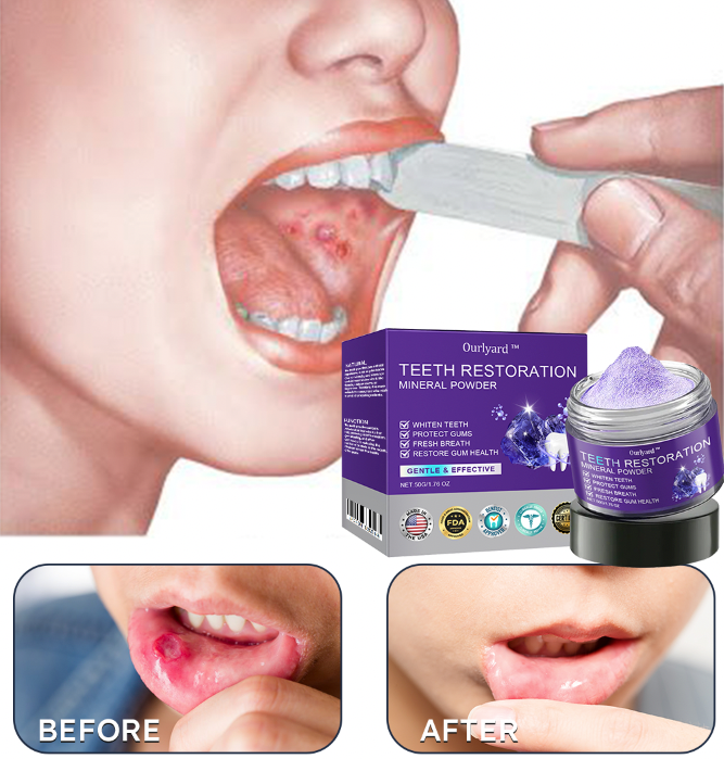 Ourlyard® Tooth Health Mineral Powder 31 Ourlyard® Tooth Health Mineral Powder