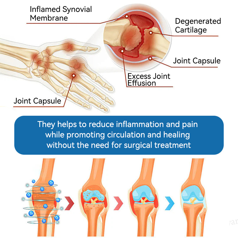 🐨🇦🇺𝐟𝐥𝐲𝐬𝐦𝐮𝐬® 𝐁𝐏𝐂-𝟏𝟓𝟕 𝐉𝐨𝐢𝐧𝐭 𝐇𝐞𝐚𝐥𝐢𝐧𝐠 𝐂𝐫𝐞𝐚𝐦🇦🇺🐨