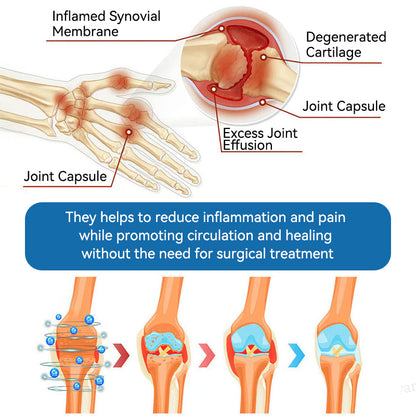 🐨🇦🇺𝐟𝐥𝐲𝐬𝐦𝐮𝐬® 𝐁𝐏𝐂-𝟏𝟓𝟕 𝐉𝐨𝐢𝐧𝐭 𝐇𝐞𝐚𝐥𝐢𝐧𝐠 𝐂𝐫𝐞𝐚𝐦🇦🇺🐨