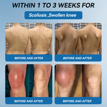 🐨🇦🇺𝐟𝐥𝐲𝐬𝐦𝐮𝐬® 𝐁𝐏𝐂-𝟏𝟓𝟕 𝐉𝐨𝐢𝐧𝐭 𝐇𝐞𝐚𝐥𝐢𝐧𝐠 𝐂𝐫𝐞𝐚𝐦🇦🇺🐨